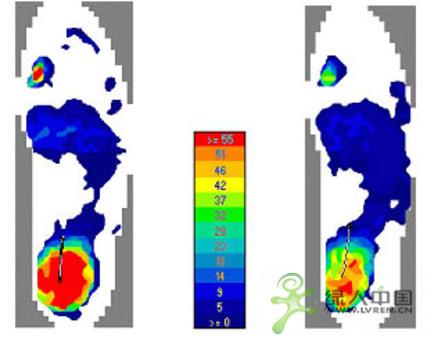 TrekSta IST-�������ռ���
